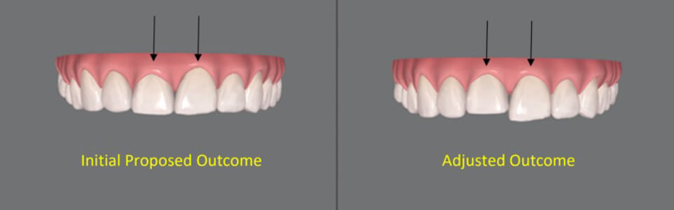 Digital Scan Proposal and Adjusted Outcome Images