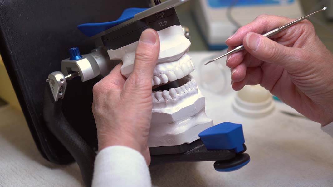 CAD/CAM Dentistry