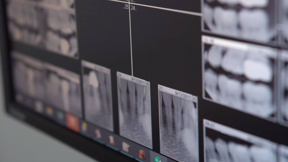 The Truth About Dental X-Ray Exposure